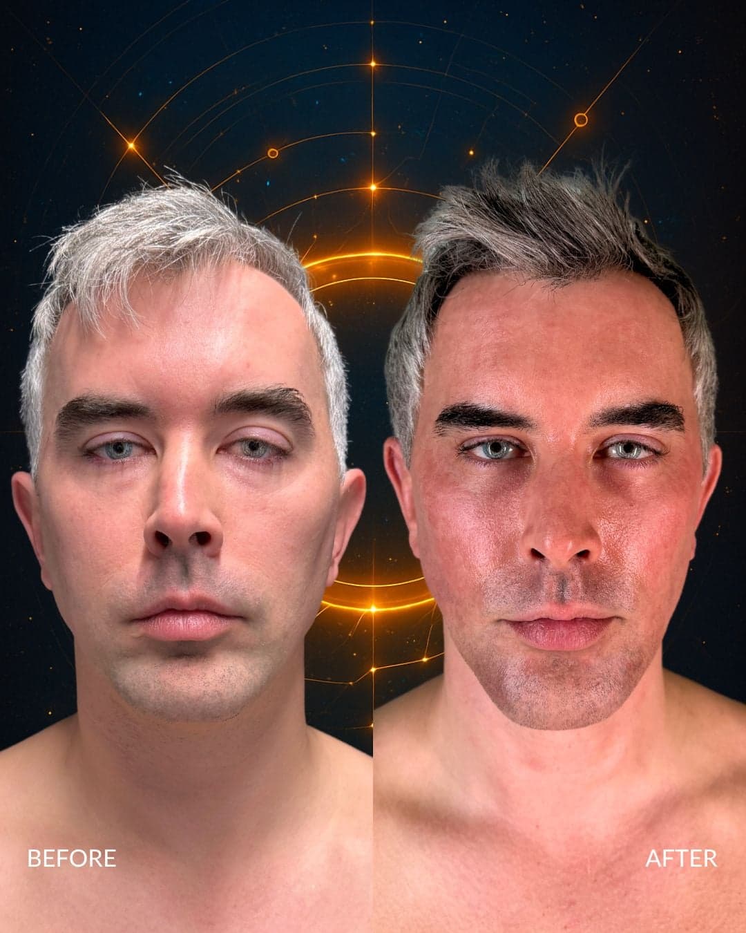 Male Facial Sculpting Before and After