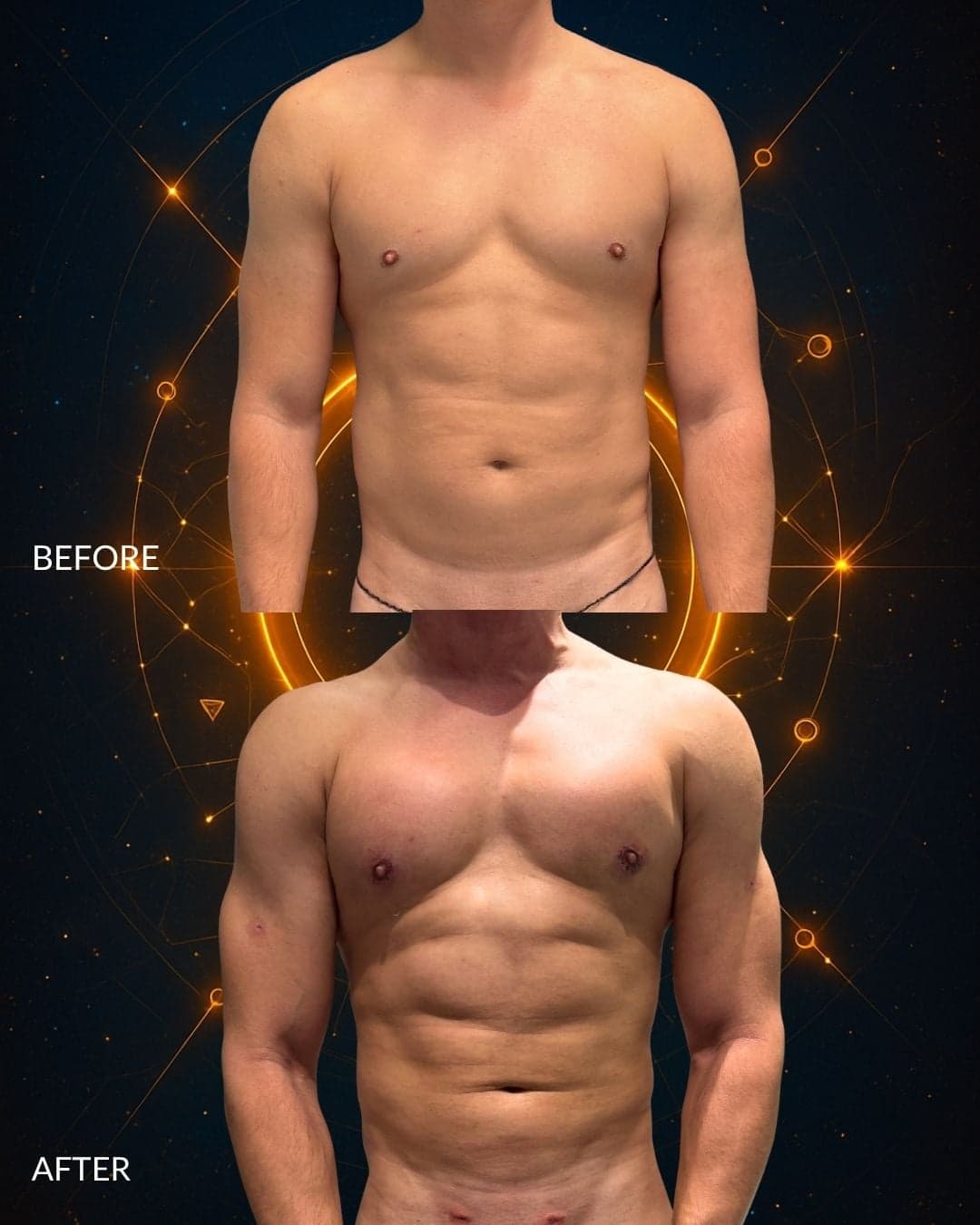MAXORIS Body Sculpting Before and After